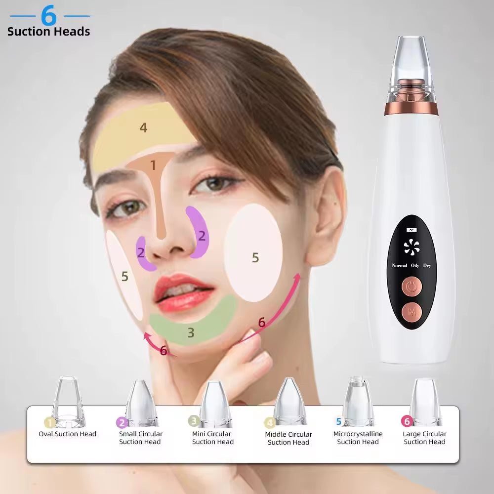 Professional Facial Blackhead Removar,Electric Pimple Acne Vacuum Pore Cleane Face Skin Care Tool Personal SPA Beauty Instrument