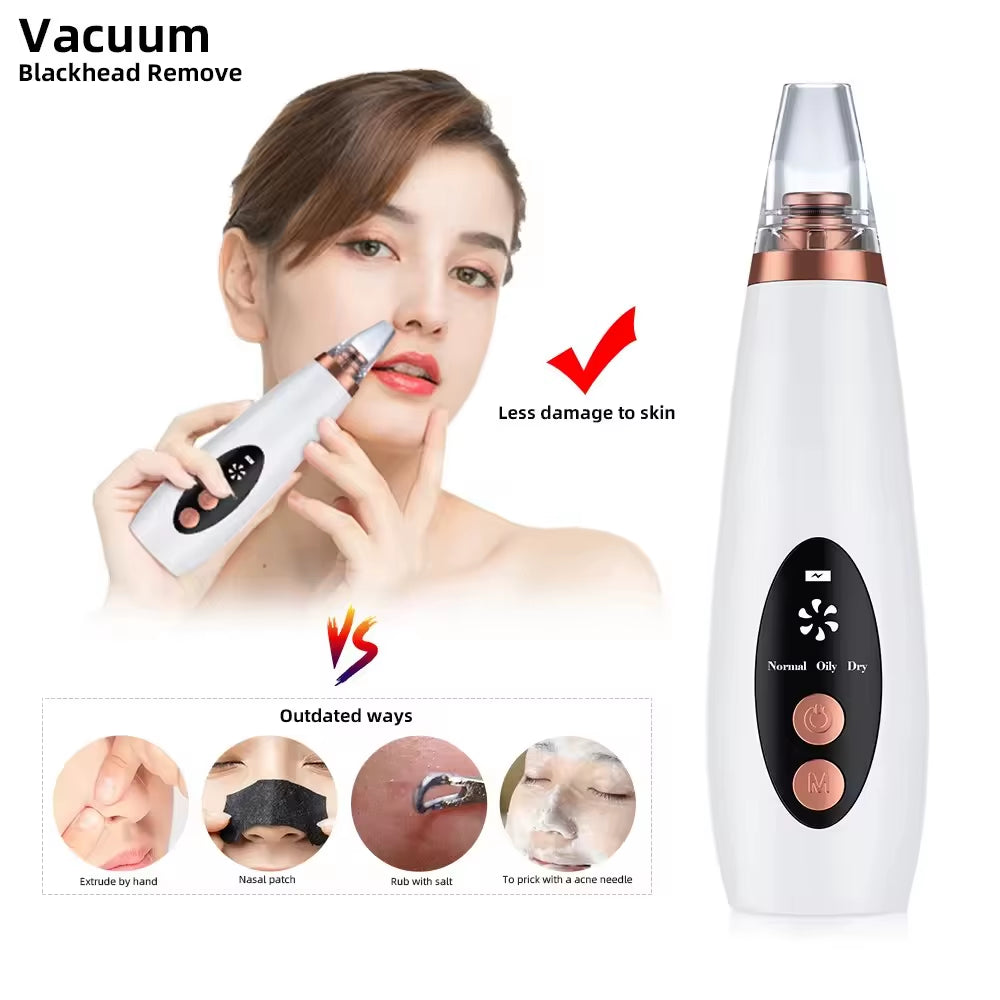 Professional Facial Blackhead Removar,Electric Pimple Acne Vacuum Pore Cleane Face Skin Care Tool Personal SPA Beauty Instrument
