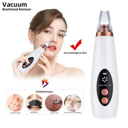 Professional Facial Blackhead Removar,Electric Pimple Acne Vacuum Pore Cleane Face Skin Care Tool Personal SPA Beauty Instrument